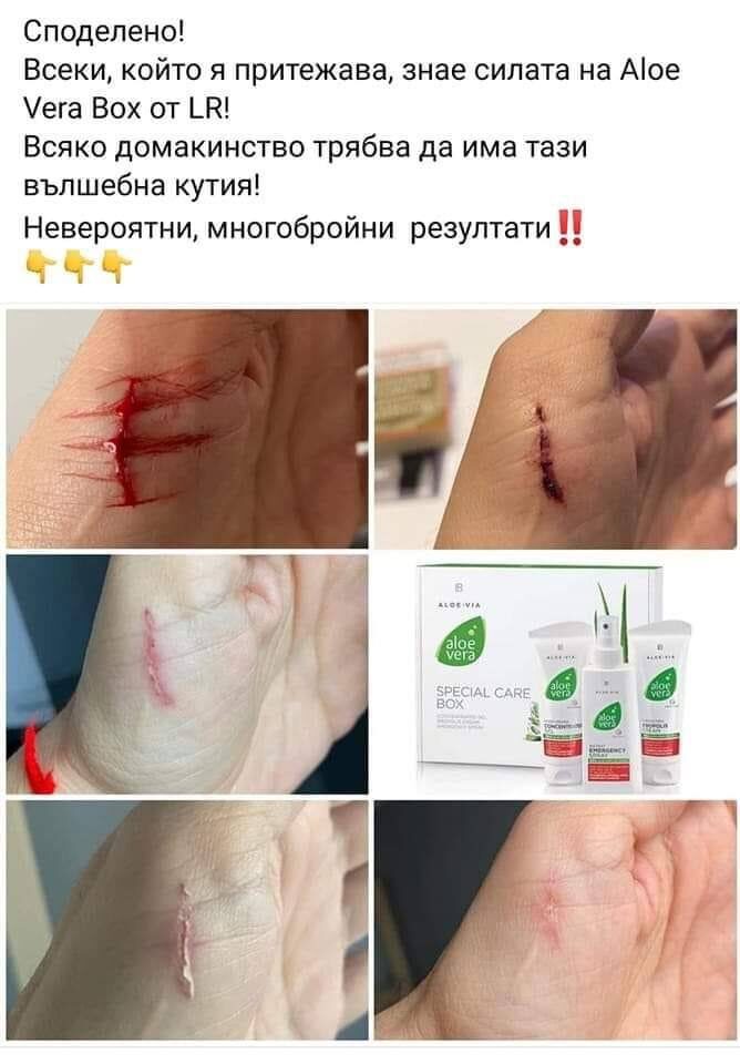Споделено от клиентка: ожулвания и порязвания — снимки преди и след ежедневна грижа с комплекта.